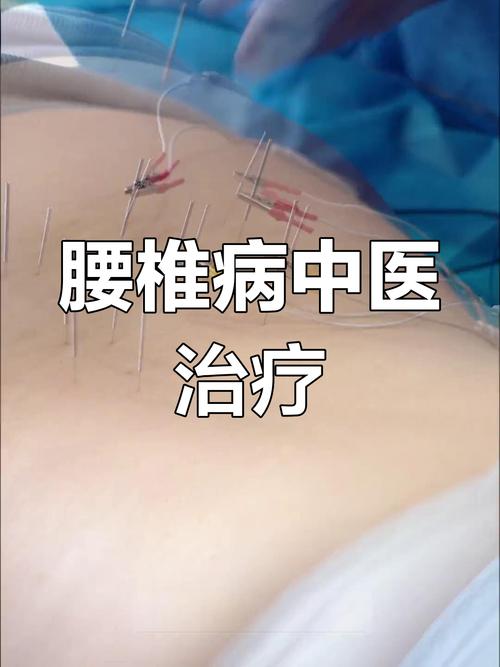 乡村医生腰腿疼论坛_腰椎间盘突出中医治疗_中医经络微创疗法