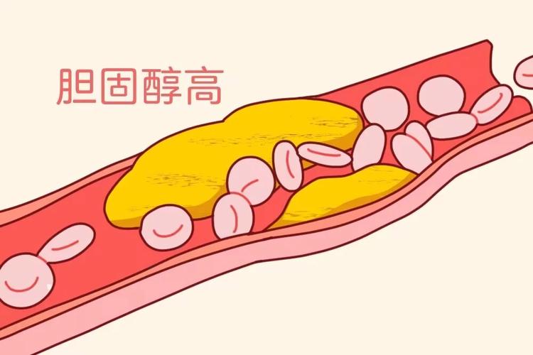 高要为什么吃蛋黄_猪油胆固醇含量_高胆固醇食物清单