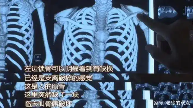 音乐人赵英俊肝癌去世_赵英俊遗书公开_大话股神赵英俊